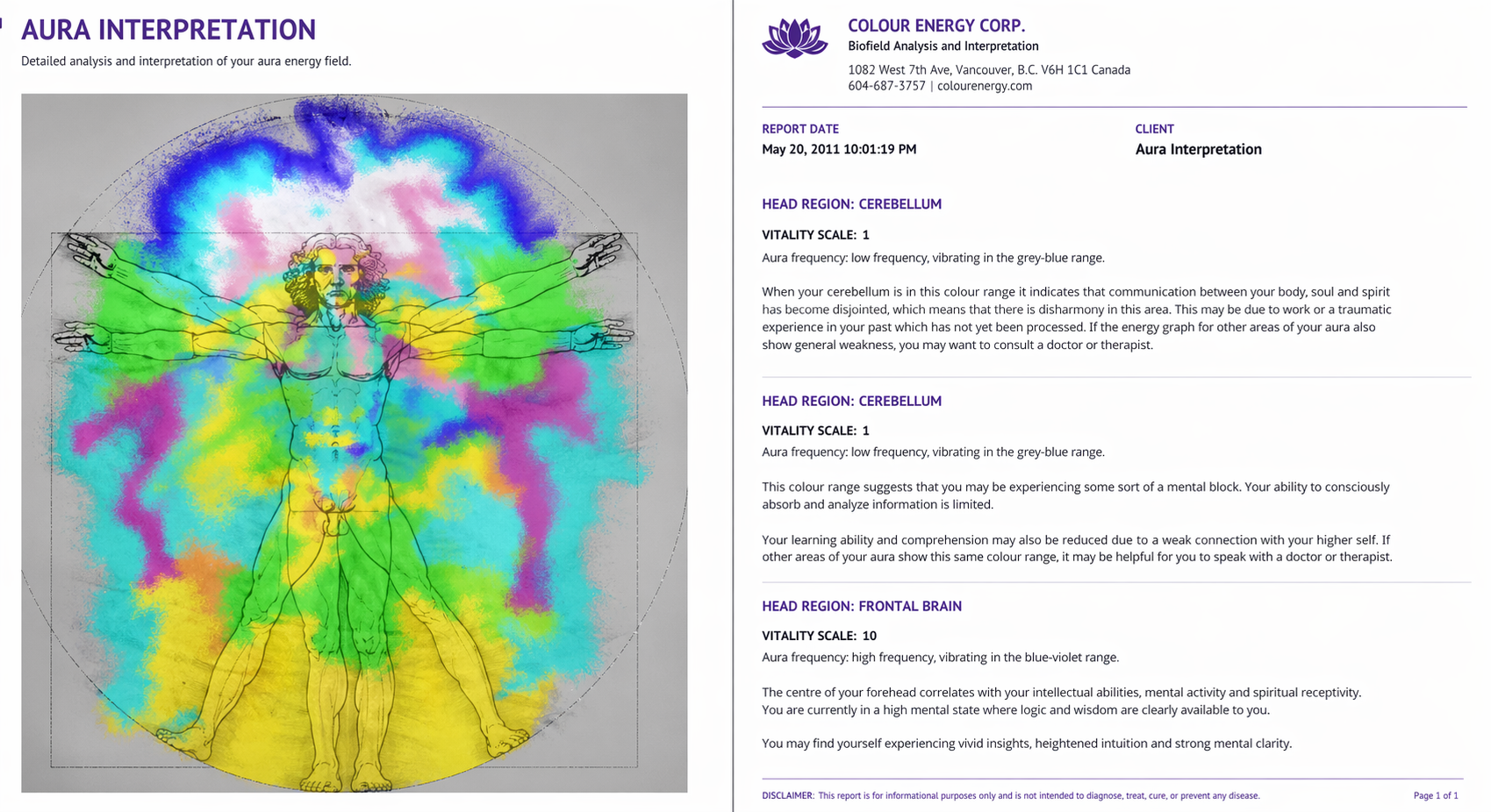 Biopulsar Reflexograph - Aura, Chakra, Organ Biofeedback Complete Package